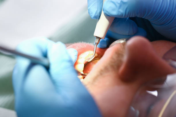 Best Emergency Gum Pain Relief  in Spiro, OK