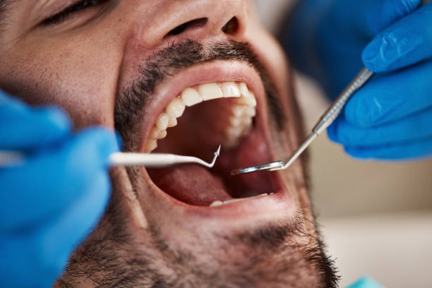 Best Teeth Whitening  in Spiro, OK